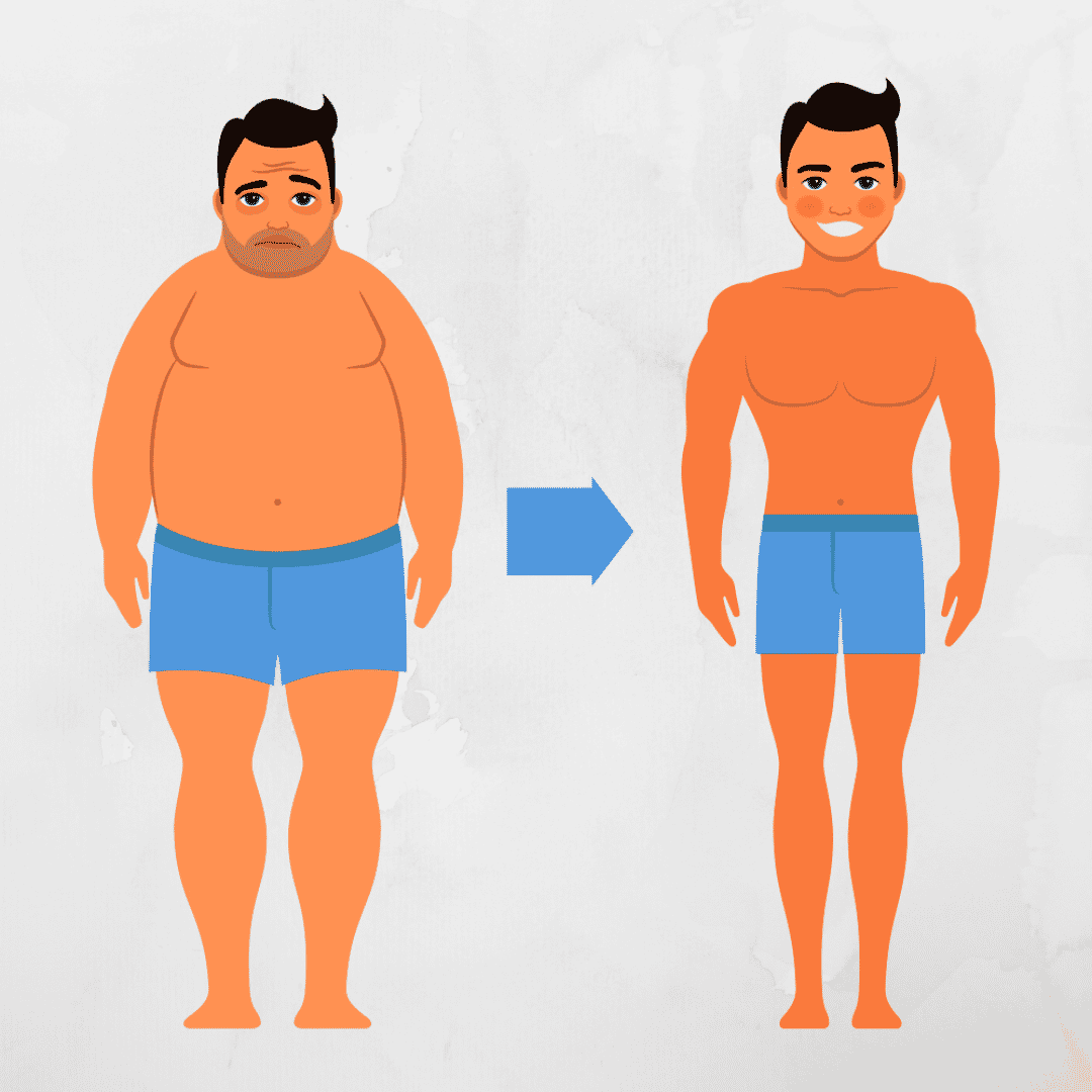 Duodenal Switch Surgery in Cancun, Mexico