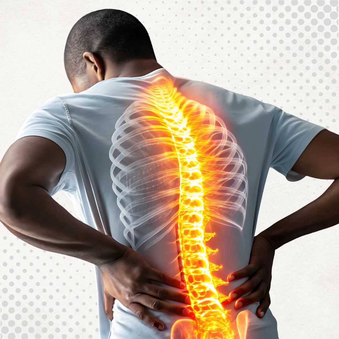 Spine Surgery in Tijuana, Mexico