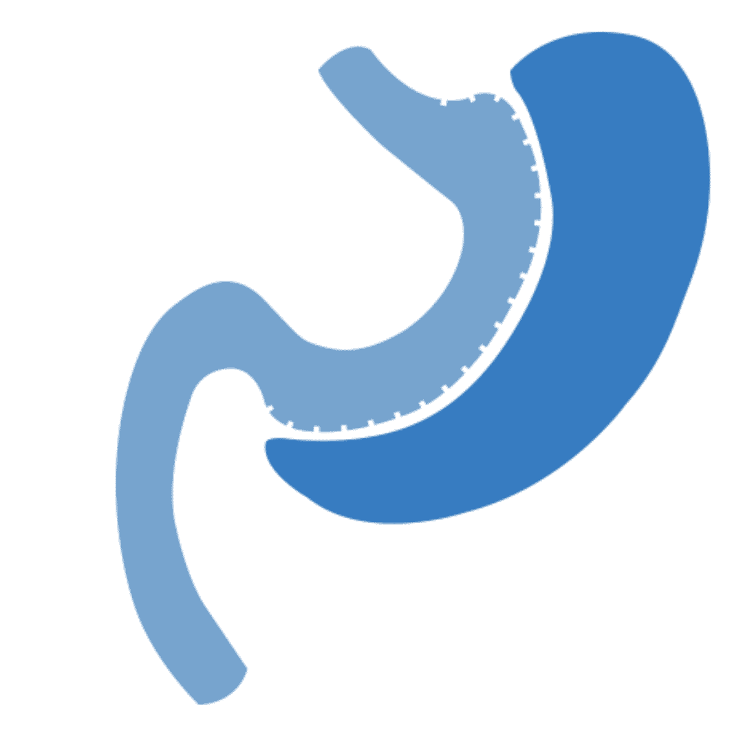 Gastric Sleeve Package in Mexico - 4500