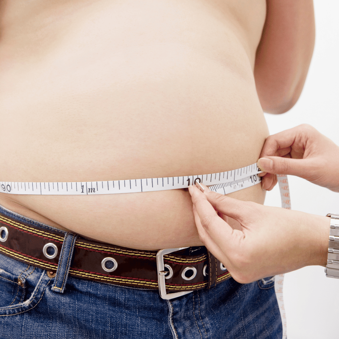 Best Gastric Sleeve Package in Cancun, Mexico