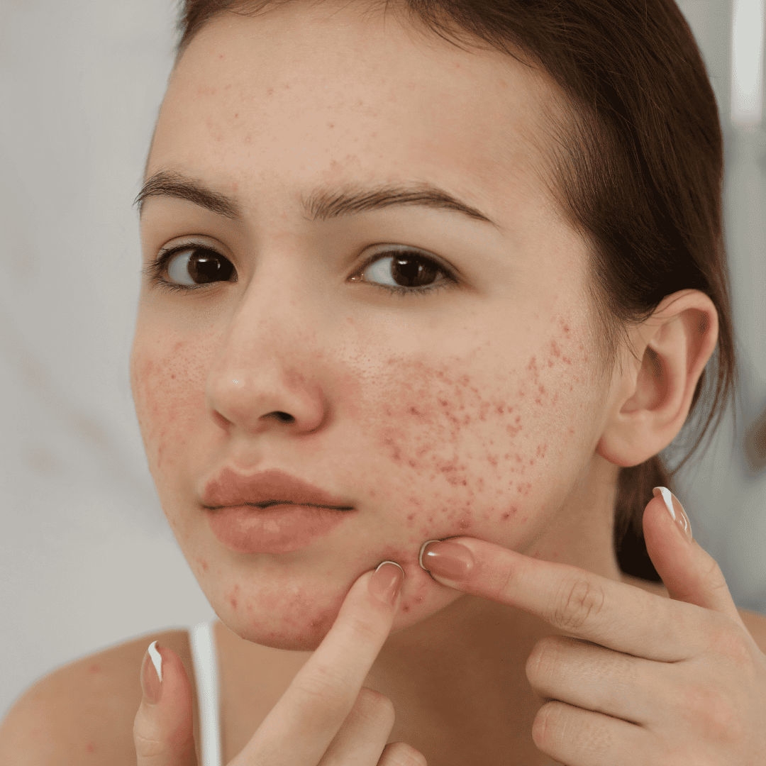 Affordable Stem Cell Mexico City Package for Scar Treatment by Dr. Ary Papadopulos