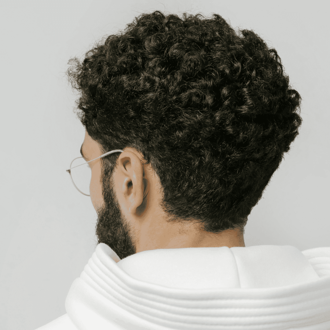 Hair Transplant Package – From 2,001 to 3,500 Grafts