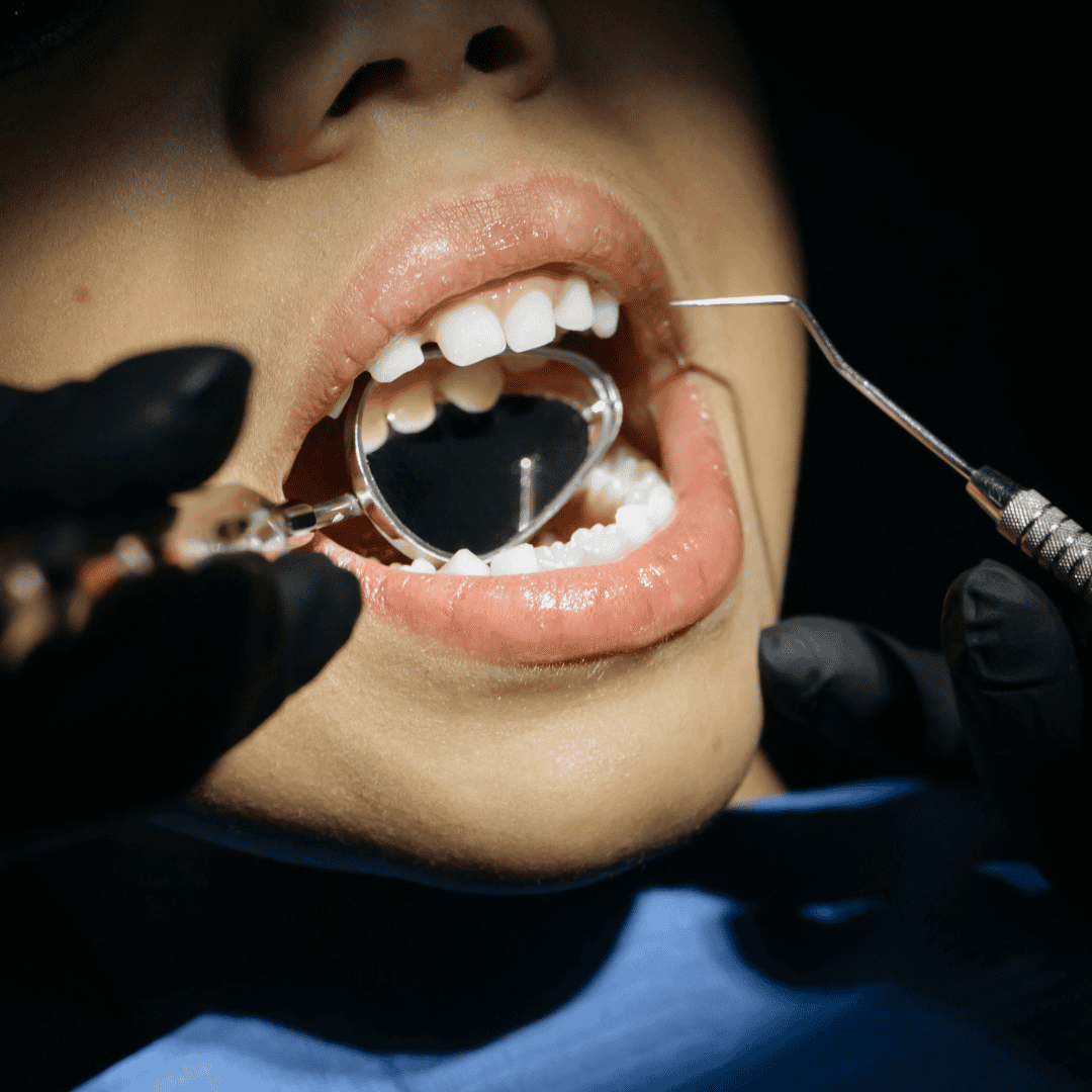 Thorough Dental Check up Package in Seoul