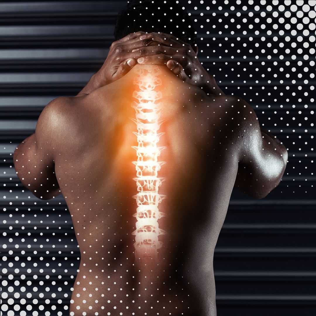 Stem Cell Therapy for Herniated Discs Package in Santo Domingo, Dominican Republic by Dr. Vargas Decamps