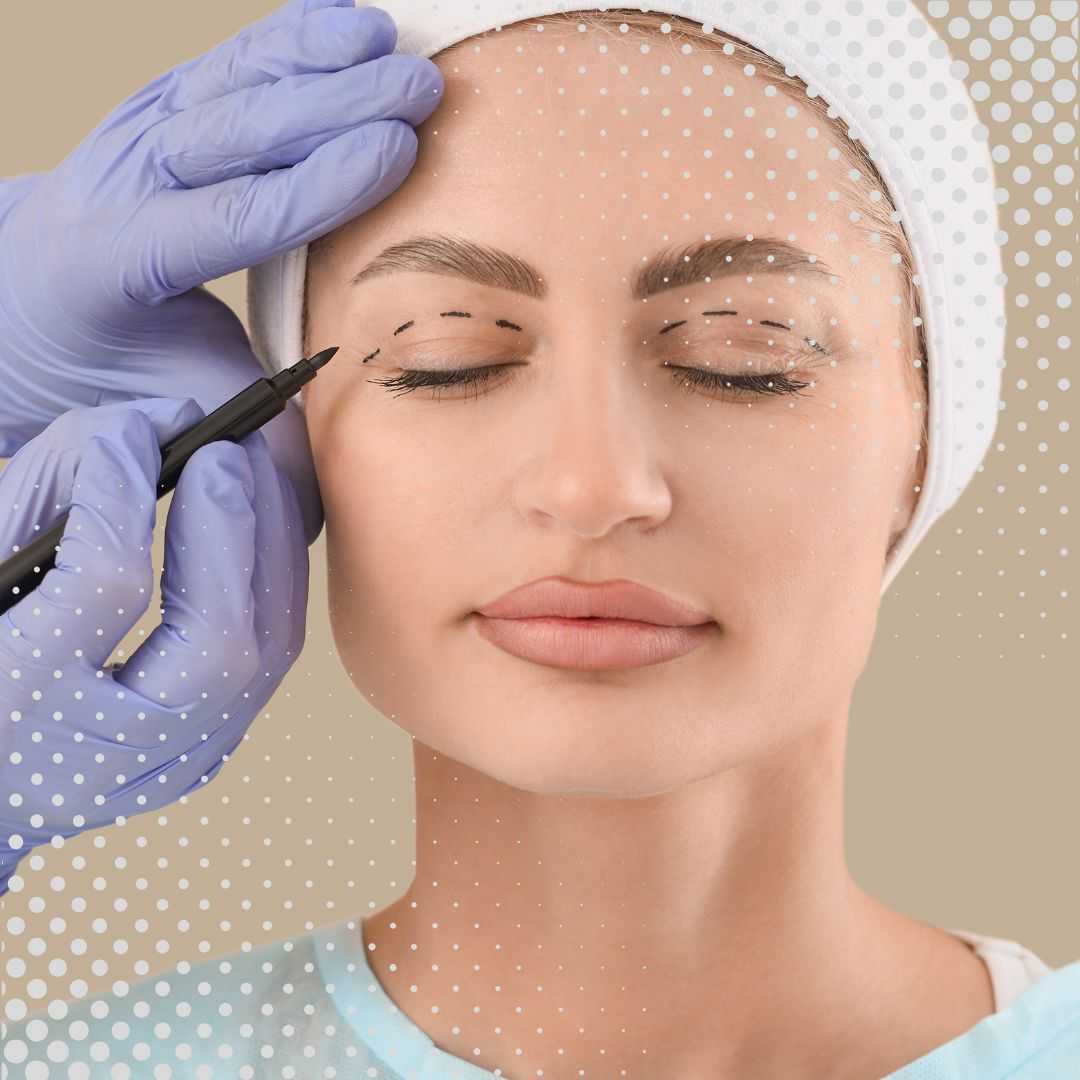 Eyelid Surgery Package in Athens, Greece by Dr. Elias Moustakis