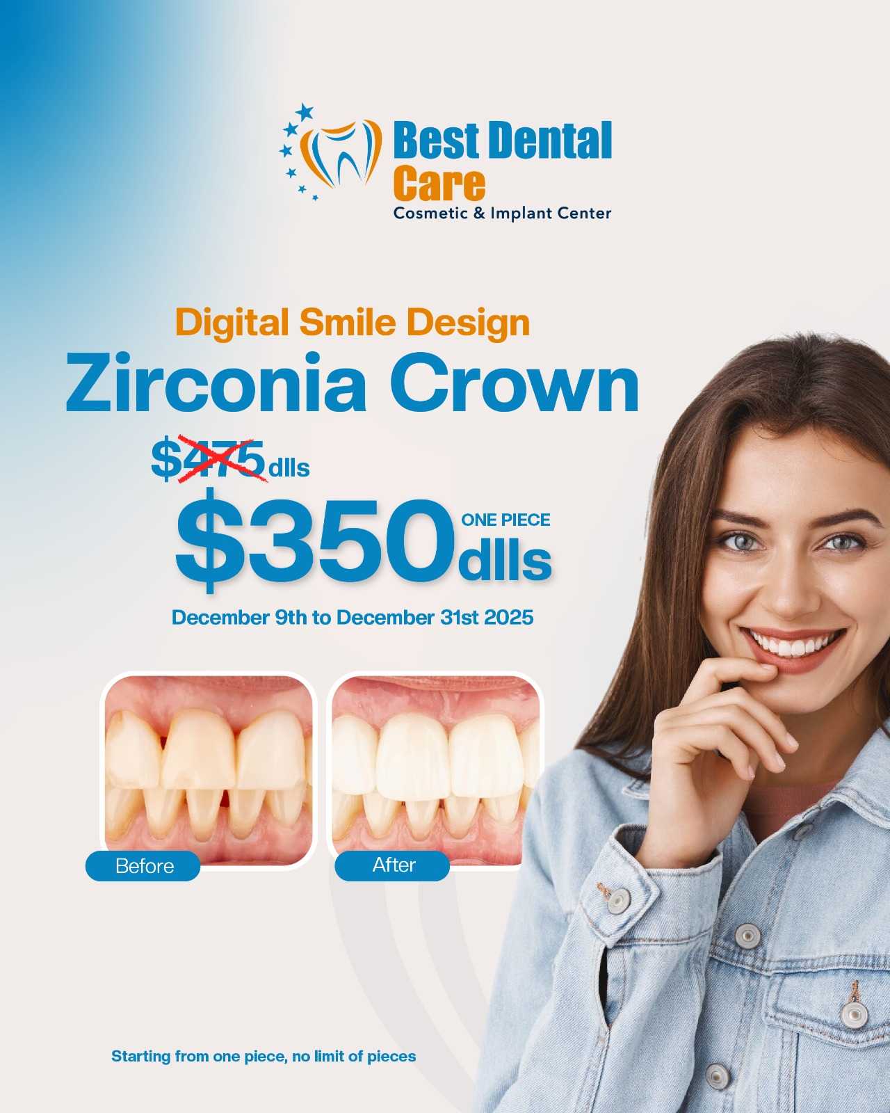 Zirconia Crowns – Limited-Time Promotion