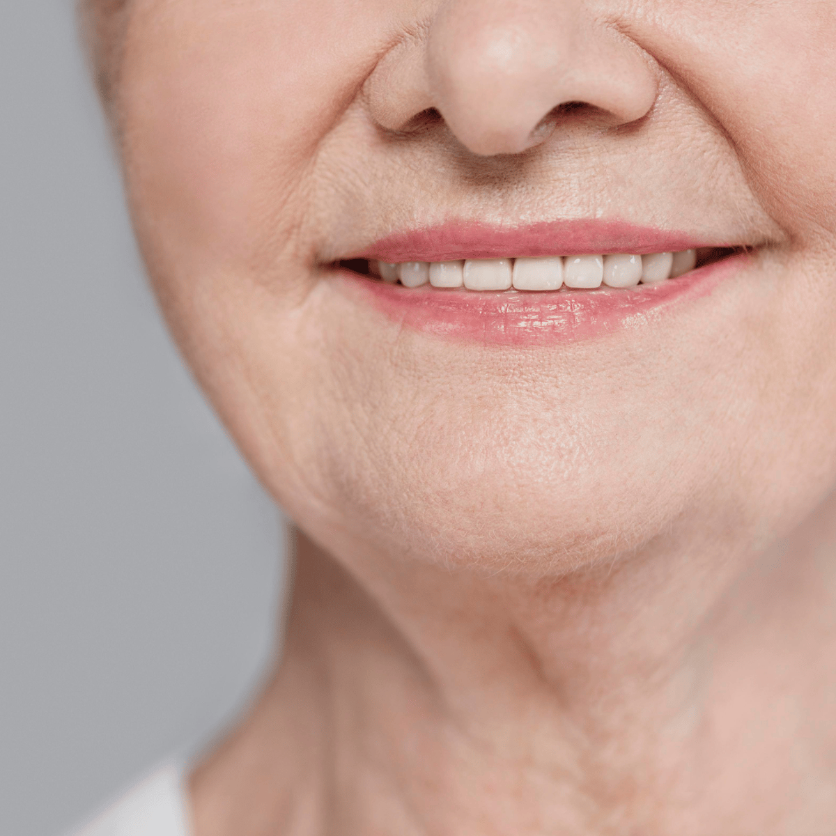 Veneers Cost in Turkey - Best Dental Clinics & Prices