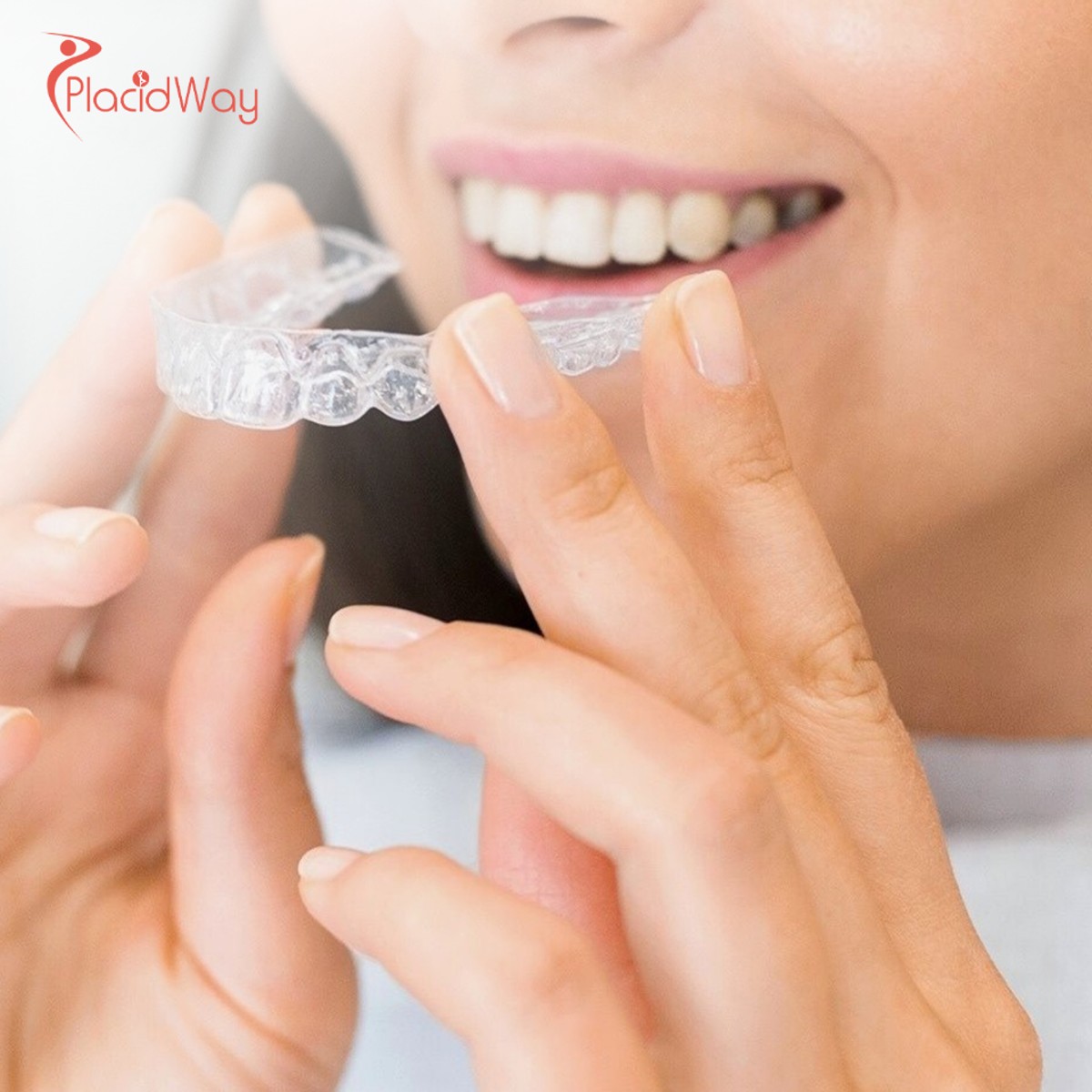 Dental Crowns in Vietnam: Enhance Your Smile with Expert Dental Care for Australians