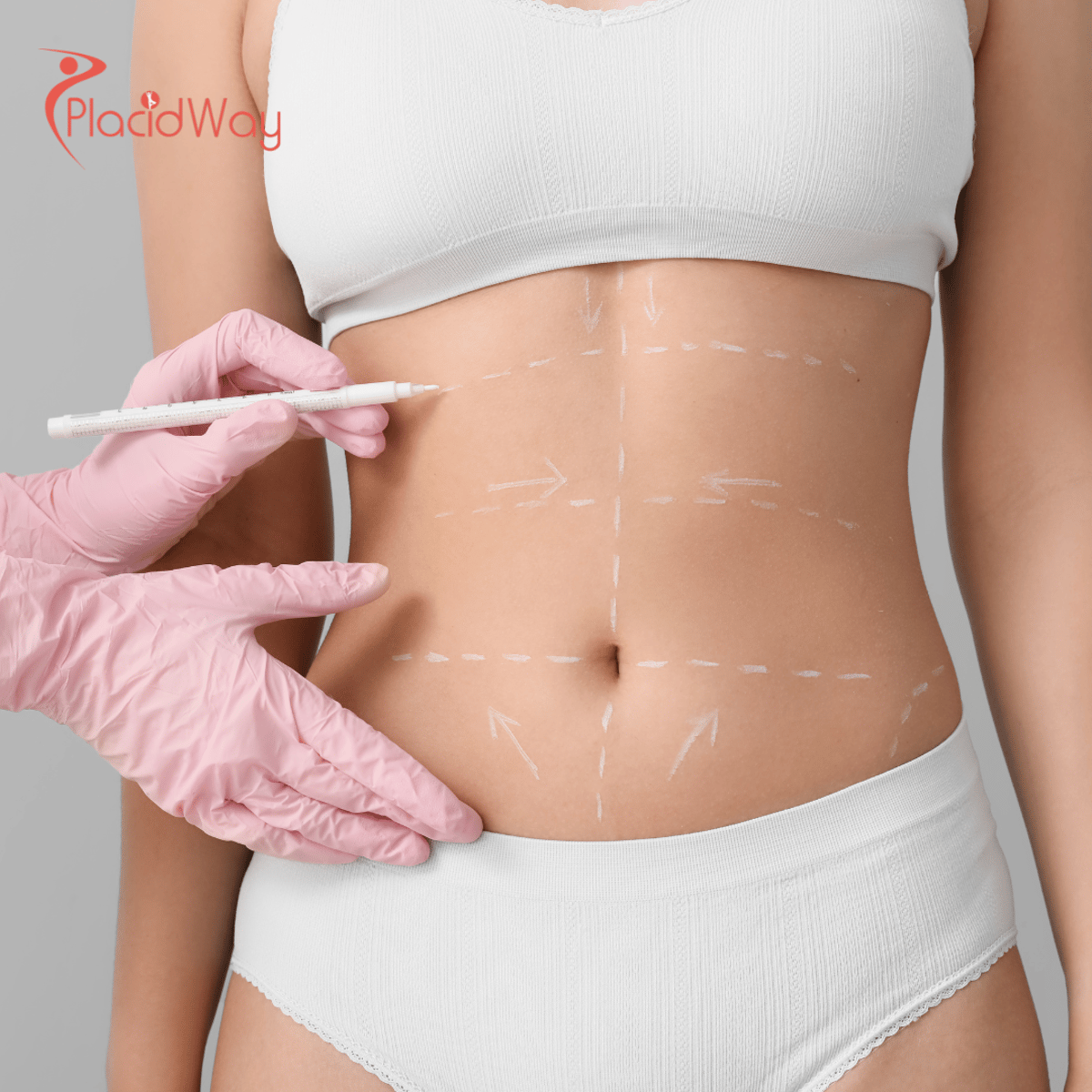 Vaser Liposuction in Istanbul: A UK Guide to Advanced Body Contouring