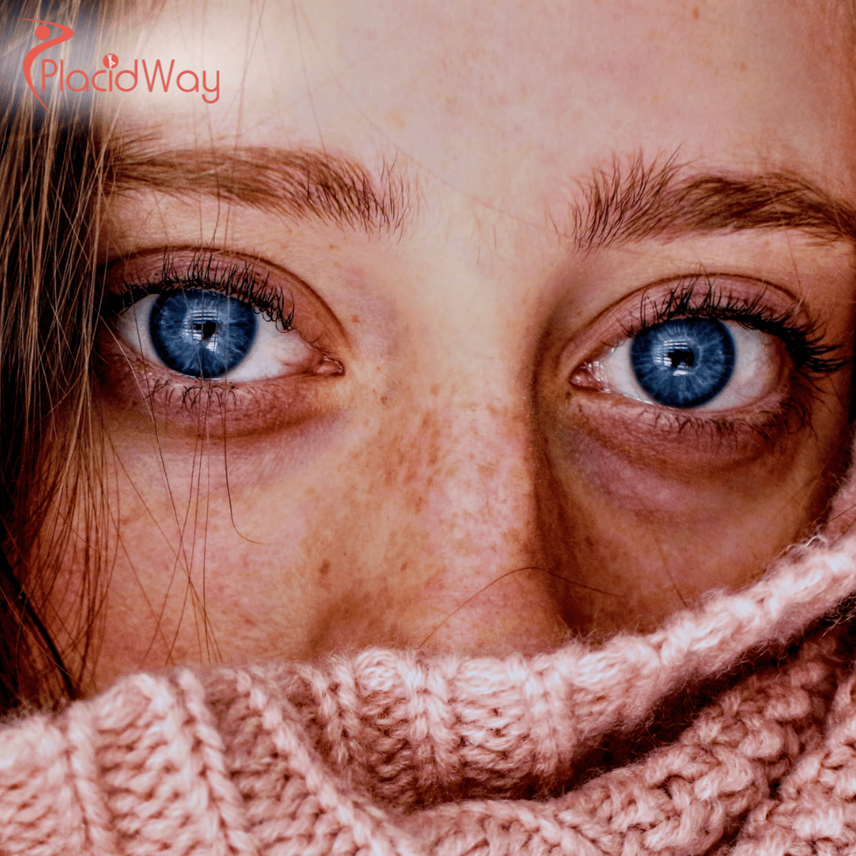 LASIK Surgery in Thailand: A Complete Guide for Australian Patients