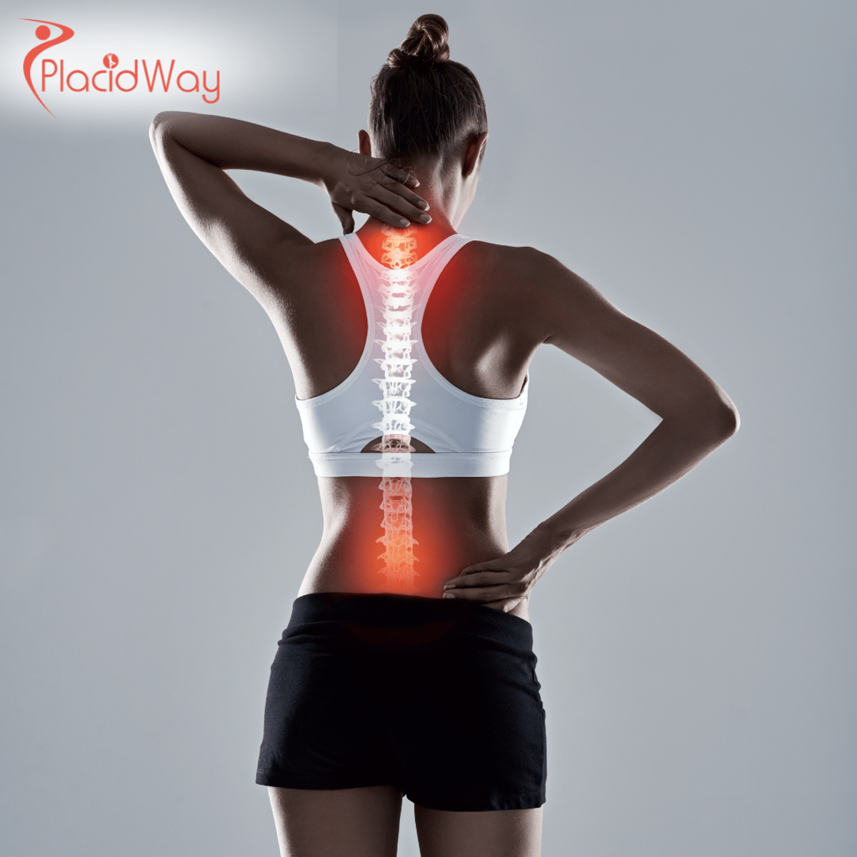 Posterior Fusion Spine Surgery in Turkey: Advanced Solution for UK Patients