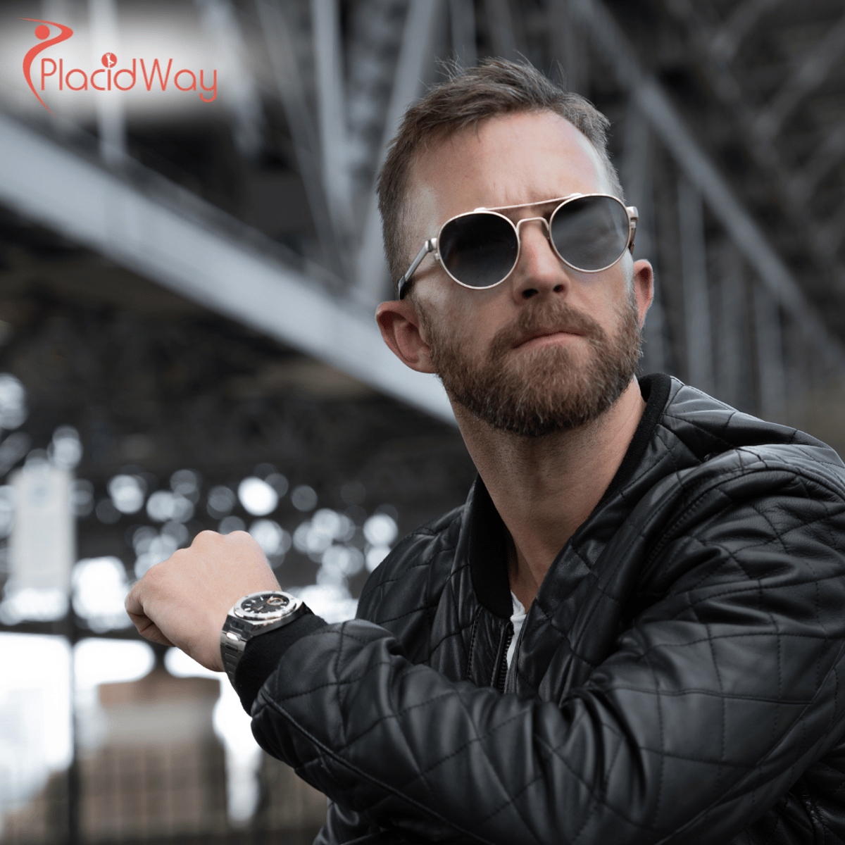 Moustache and Beard Transplant in Turkey: Expert Hair Restoration Helping German Patients Regain Confidence