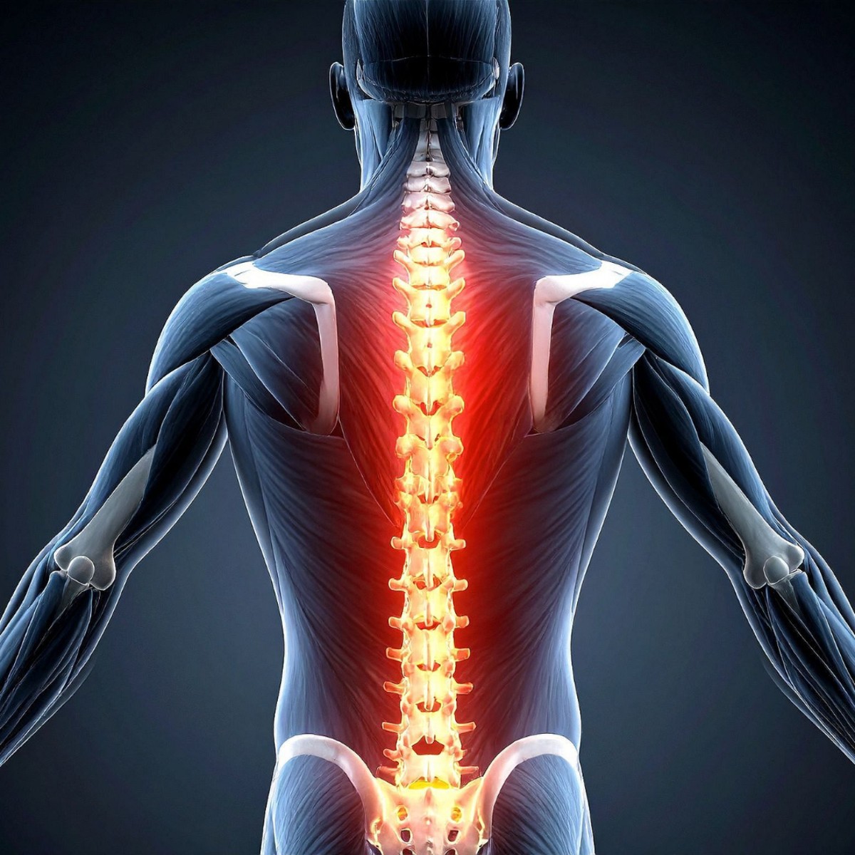 Spinal Fusion Surgery: India vs. Turkey - A Comprehensive Comparison