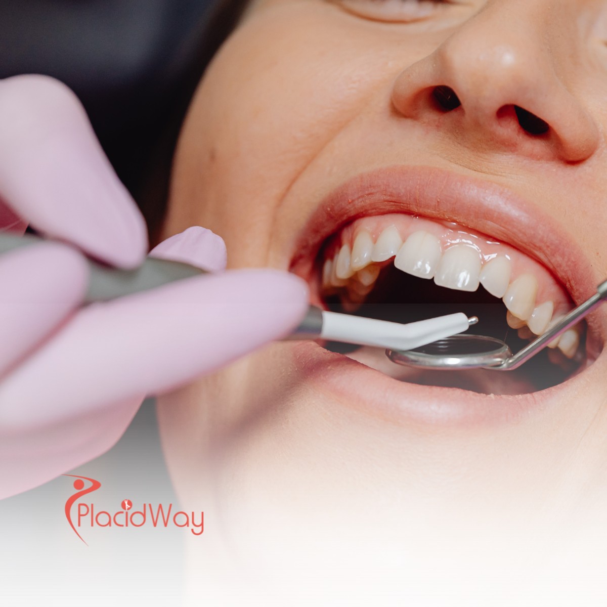 How to Save on Full Mouth Restoration in Thailand as a New Zealand Resident