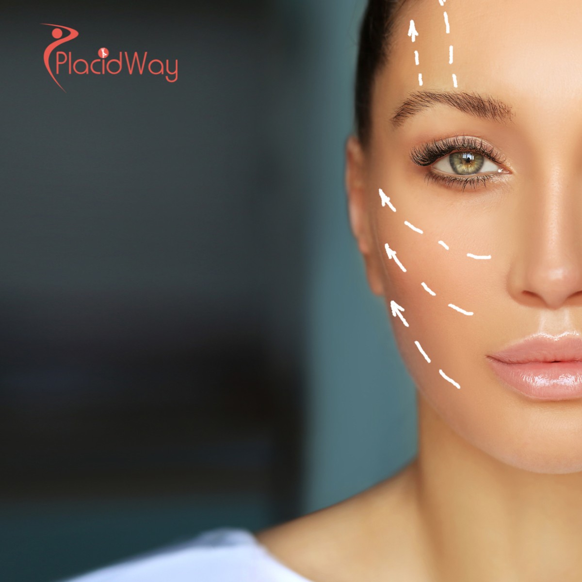 Non-Surgical Facelifts in Colombia: Affordable Skin Rejuvenation for St. Lucian Patients