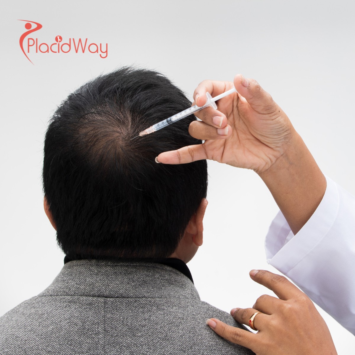Stem Cell Hair Regrowth in Japan: The Ultimate Guide to Regenerative Hair Restoration