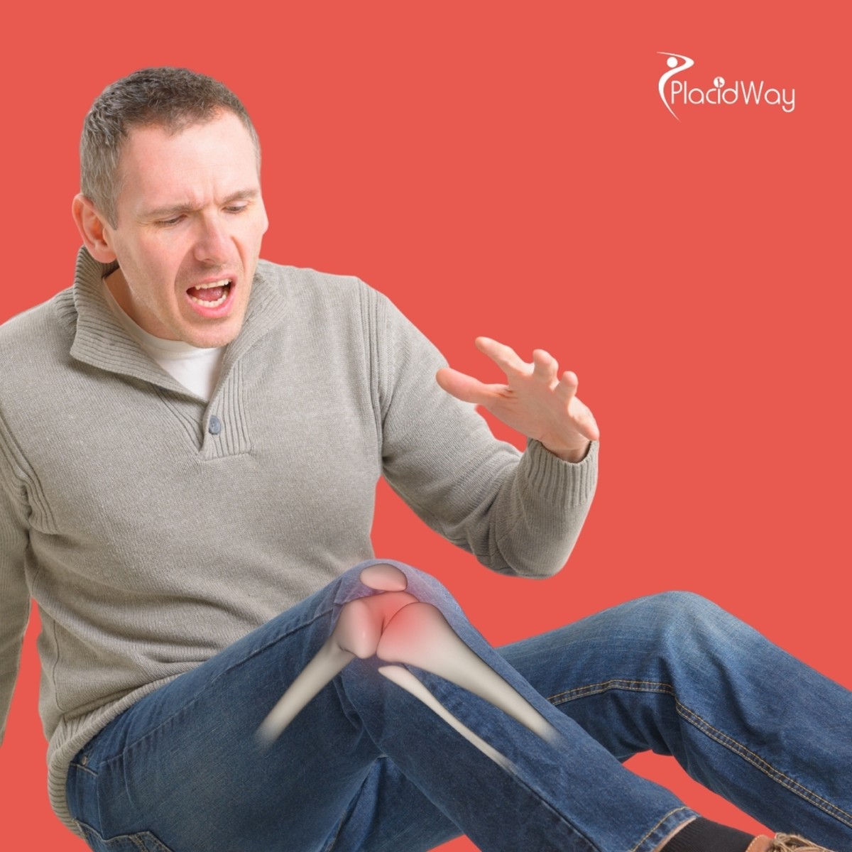 Stem Cell Therapy for Knee Osteoarthritis in Mexico: Brazilian Patient Guide