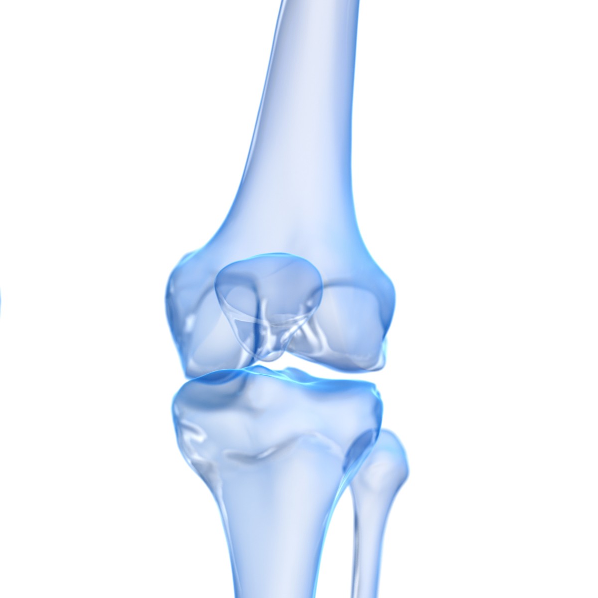 Joint Pain Treatment in Turkey for Uzbekistan – Proven Results, Modern Techniques