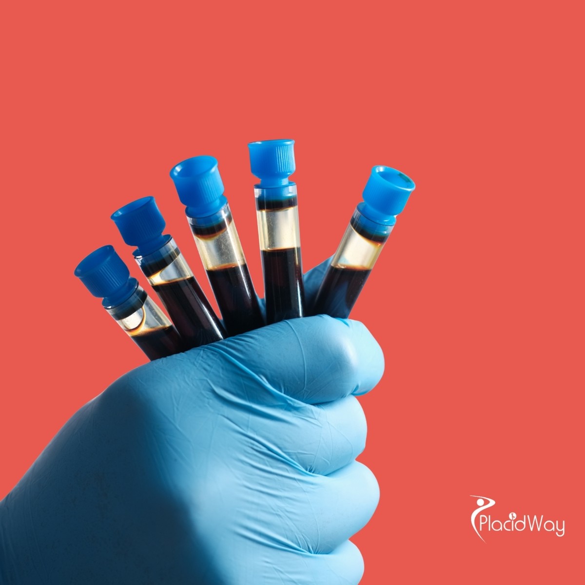 Restoring Strength and Wellness: Why Nigerian Patients Choose the UAE for PRP Stem Cell Therapy