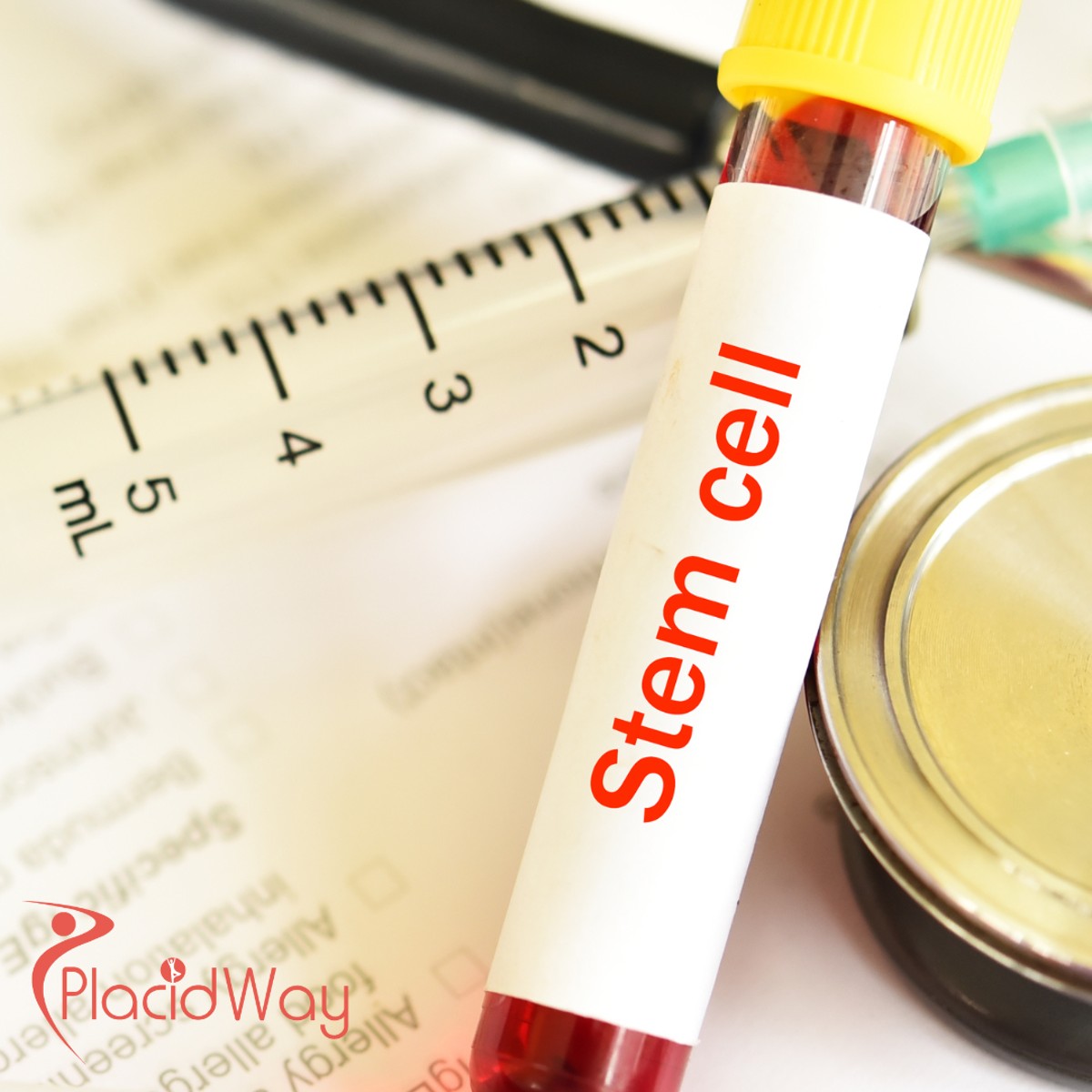 Affordable Stem Cell Treatment in Mexico for German Patients Exploring Non-Surgical Options