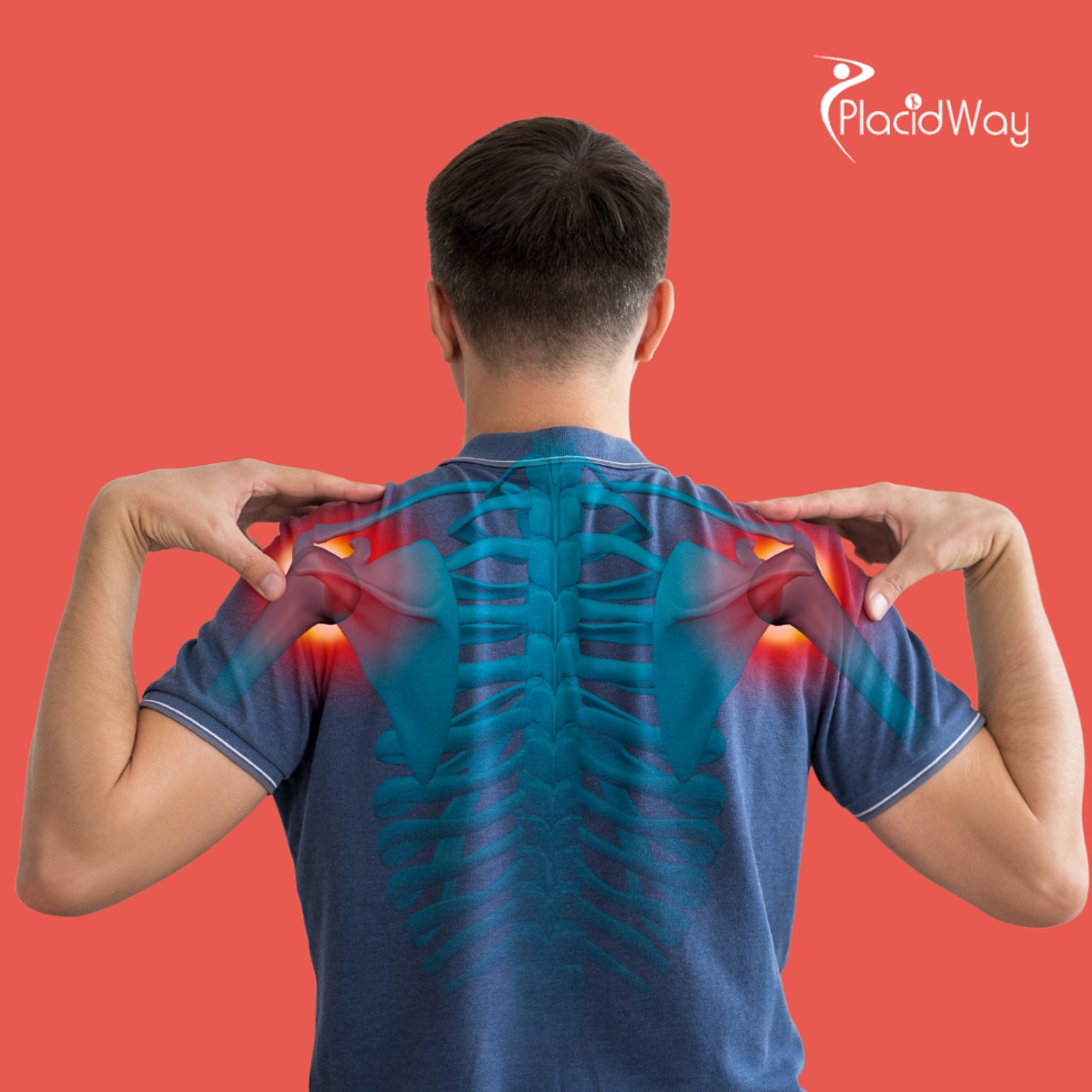 Stem Cell Treatment for Joint Pain in India for Melbourne Patients