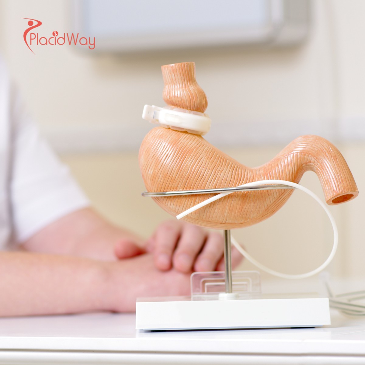 Revisional Bariatric Surgery in Turkey for Patients Restarting Their Weight Loss Journey