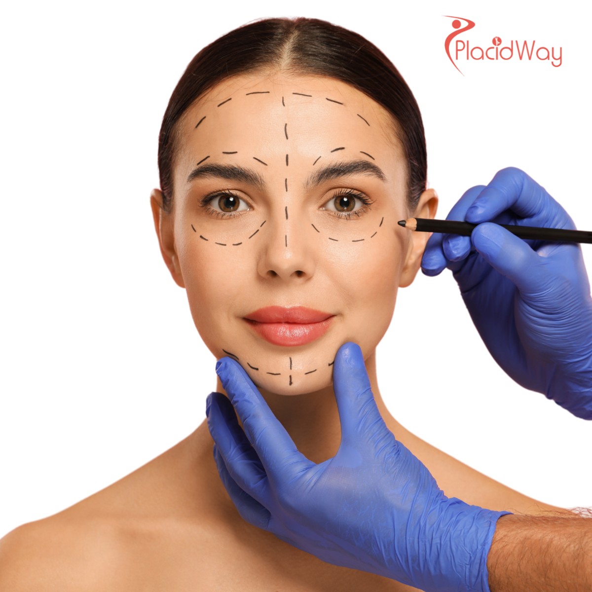 V-Line Jaw Surgery in South Korea for Facial Harmony and Contouring Results Patients Seek