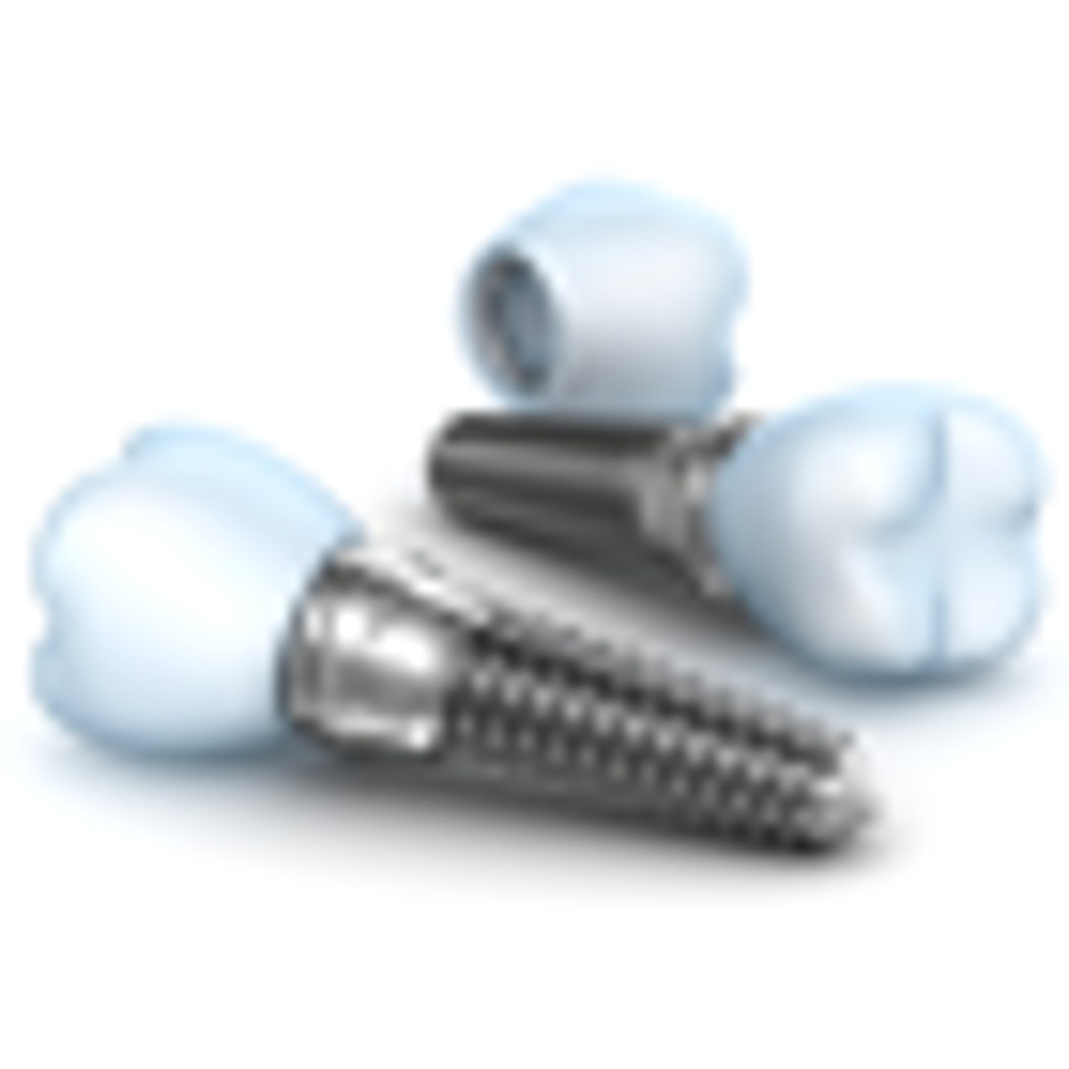 Dental Implants in Thailand: Cost, Types, Process & Benefits