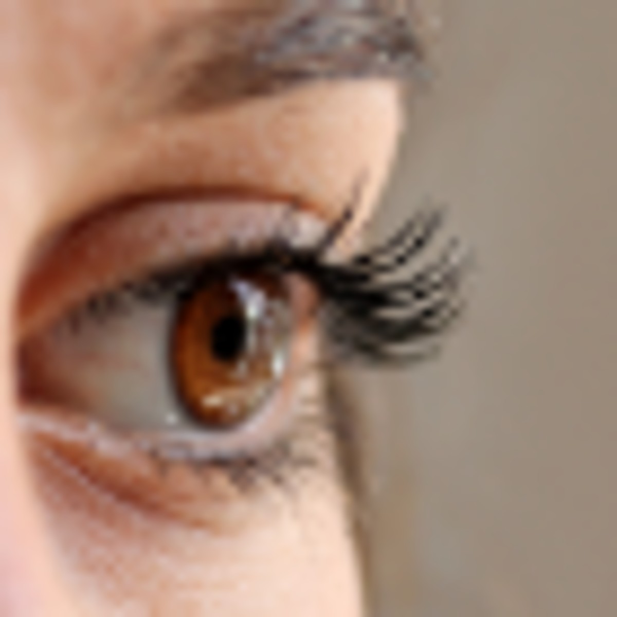 How to Find Lasik Monovision Surgery Options in Antalya, Turkey