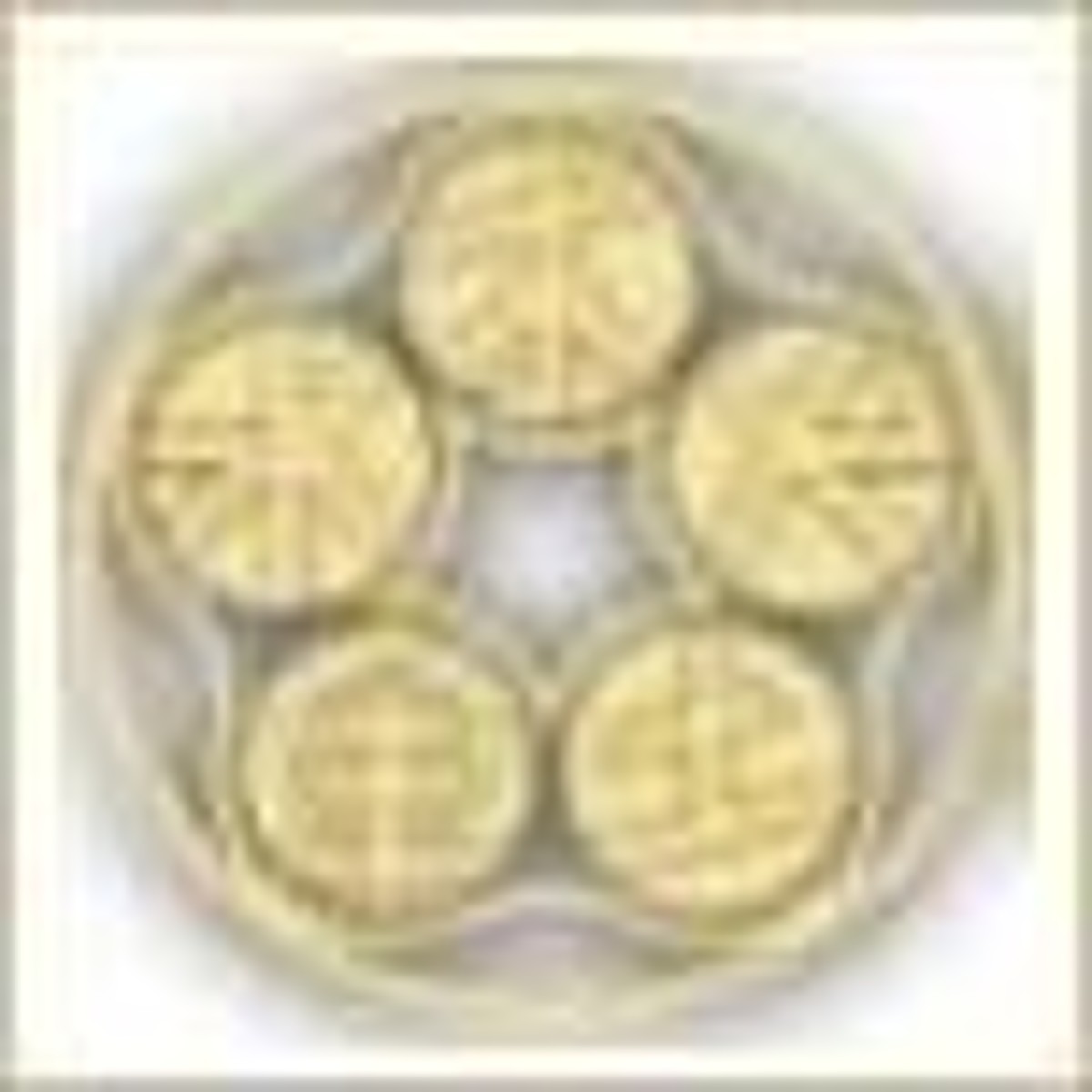 Stem Cell Treatments for Alzheimer's Disease