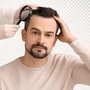 Hair Transplantation Package in Malta by St. Mary’s Clinic thumbnail
