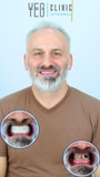 Full Mouth Restoration Package at YEG Clinic - Best Dental Clinic Istanbul, İstanbul, Turkey thumbnail
