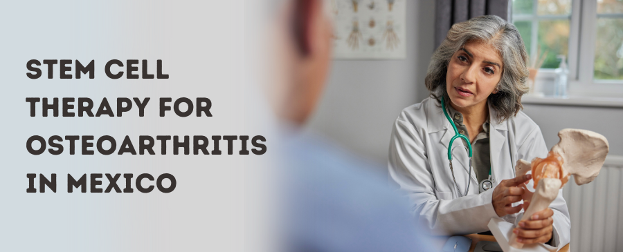 Osteoarthritis Stem Cell Treatment in Mexico