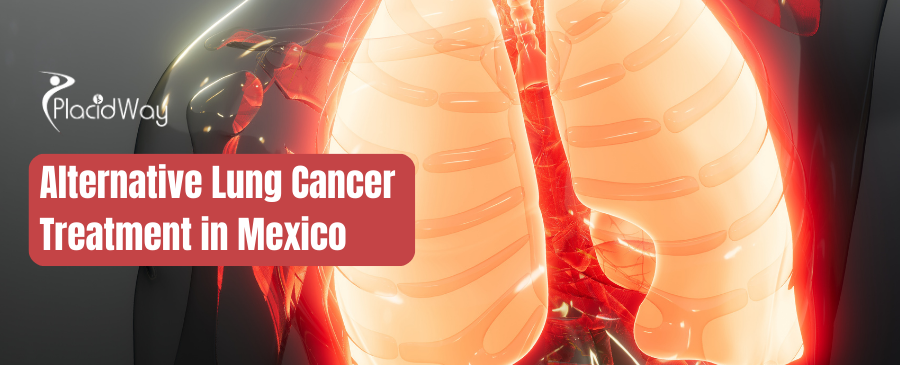 Alternative Lung Cancer Treatment Mexico