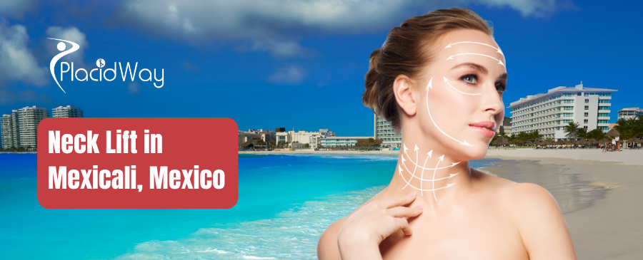 Neck Lift in Mexicali, Mexico