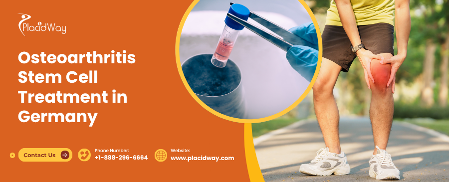 Osteoarthritis Stem Cell Treatment in Germany