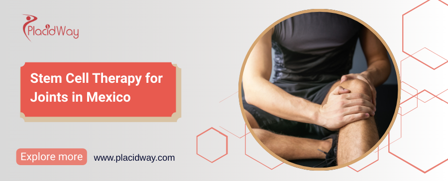 Stem Cell Therapy for Joints in Mexico
