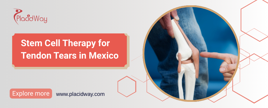 Stem Cell Therapy for Tendon Tears in Mexico