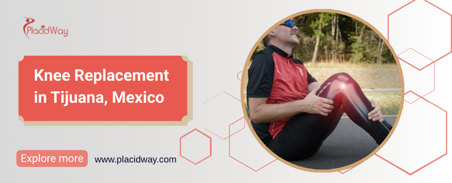 Knee Replacement in Tijuana, Mexico