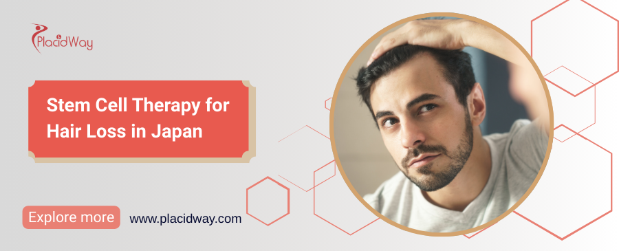 Stem Cell Therapy for Hair Loss in Japan