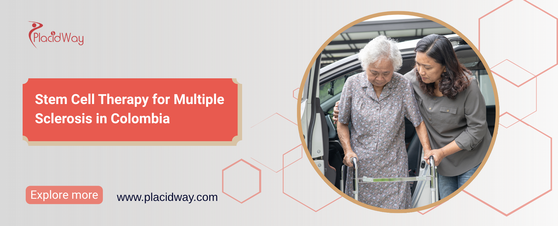 Stem Cell Therapy for Multiple Sclerosis in Colombia