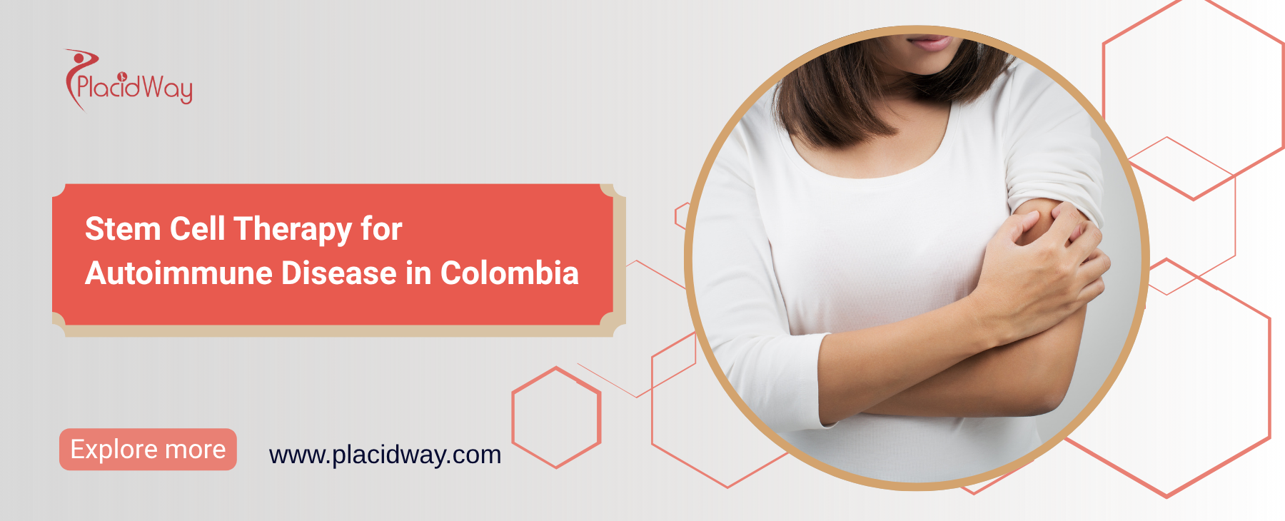 Stem Cell Therapy for Autoimmune Disease in Colombia