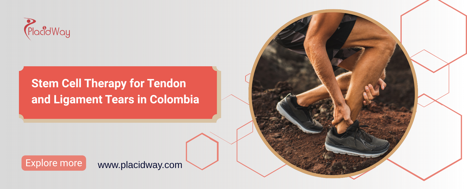Stem Cell Therapy for Tendon and Ligament Tears in Colombia