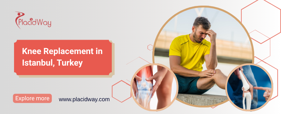 Knee Replacement in Istanbul, Turkey