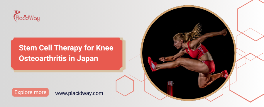 Stem Cell Therapy for Knee Osteoarthritis in Japan