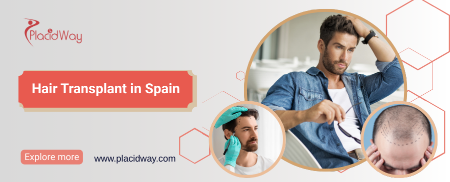 Hair Transplant in Spain