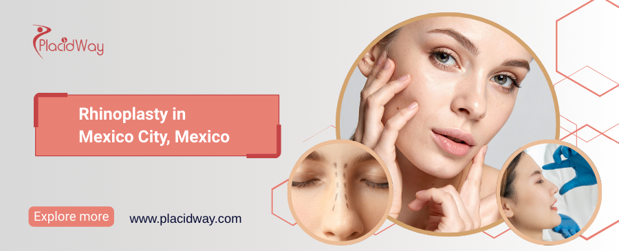 Rhinoplasty in Mexico City, Mexico