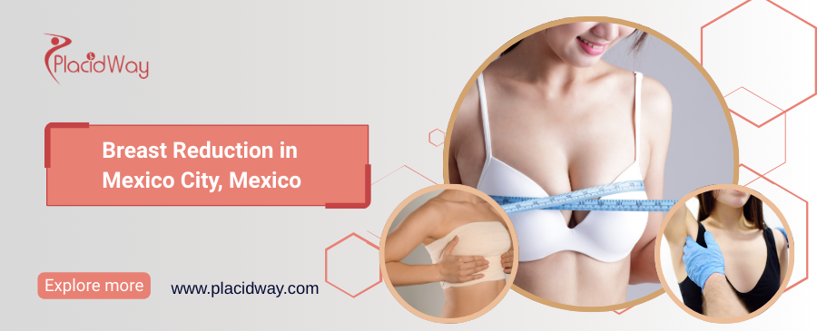 Breast Reduction in Mexico City, Mexico