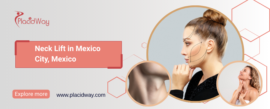 Neck Lift in Mexico City, Mexico