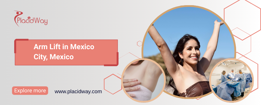 Arm Lift in Mexico City, Mexico